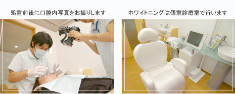 処置前に口腔内写真をお撮りします。ホワイトニングは個室診療室で行います。